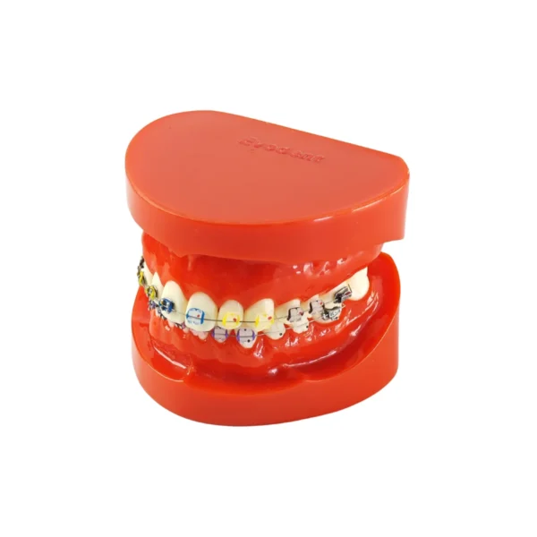 Evodent Orthodontic Bracket Model For Metal and Ceramic Bracket Red
