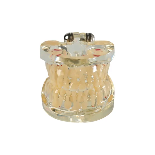 Evodent Signature Mixed Dentition Model Without Caries Clear