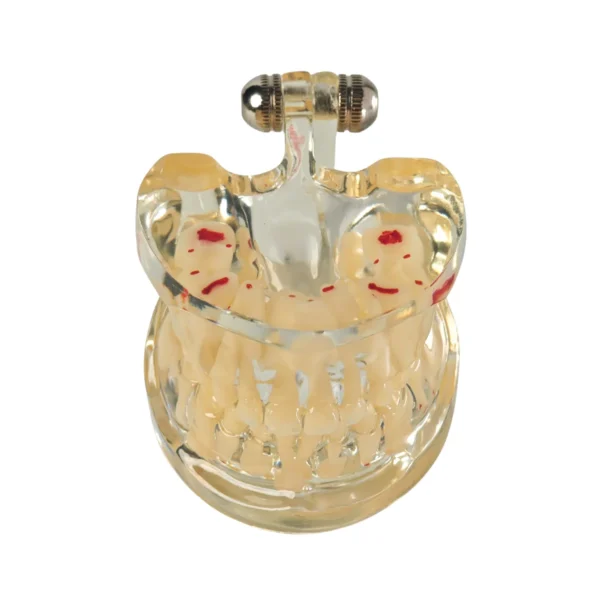 Evodent Signature Mixed Dentition Model Without Caries Clear