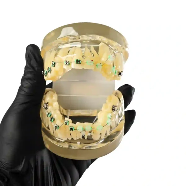 Evodent Signature Malocculation model with Metal and Ceramic Bracket