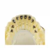 Evodent Orthodontic Model With Lingual Bracket 5 Evodent Orthodontic Model With Lingual Bracket