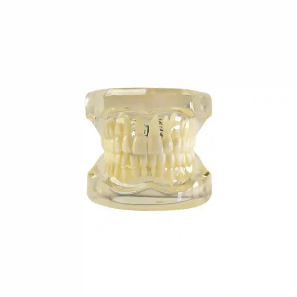 Evodent Orthodontic Model with Lingual Bracket