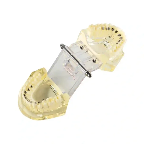 Evodent Orthodontic Model with Lingual Bracket