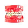 Evodent Orthodontic Model With Metal Bracket Red