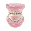 Evodent Orthodontic Model With Metal Bracket
