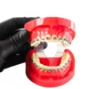 Evodent Orthodontic Model With Metal Bracket Red