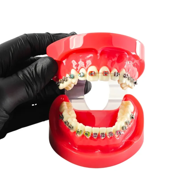 Evodent Orthodontic Model with Metal Bracket Red
