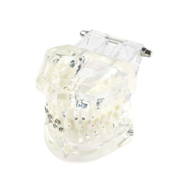 Evodent Orthodontic Model with Metal and Ceramic Bracket