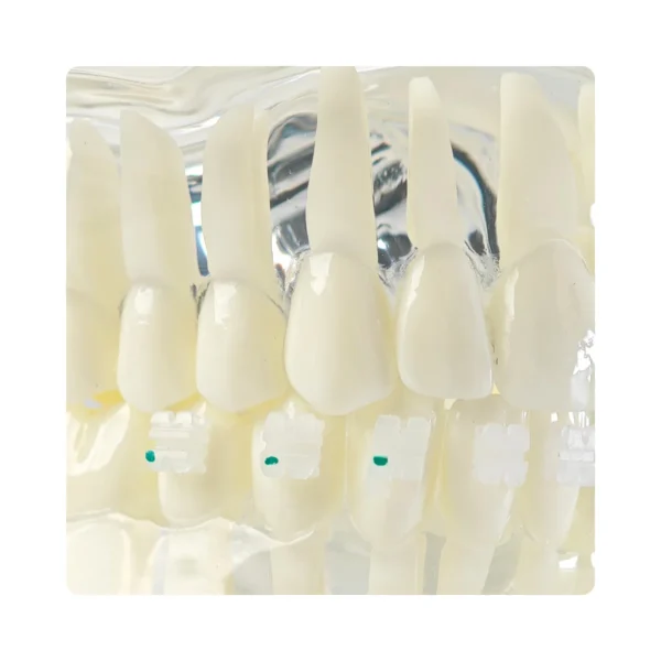 Evodent Four in One Orthodontic Bracket Types Demonstration Model – Metal, Ceramic, Self-Ligating & Lingual Braces