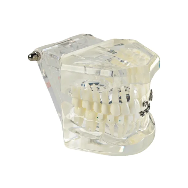 Evodent Four in One Orthodontic Bracket Types Demonstration Model – Metal, Ceramic, Self-Ligating & Lingual Braces