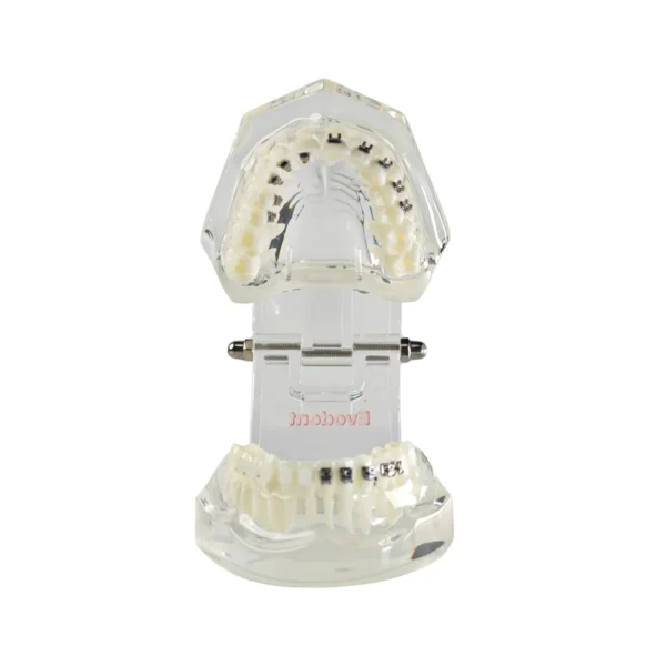 Evodent Four in One Orthodontic Bracket Types Demonstration Model – Metal, Ceramic, Self-Ligating & Lingual Braces