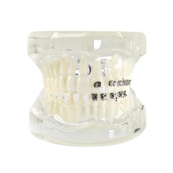 Evodent Four in One Orthodontic Bracket Types Demonstration Model – Metal, Ceramic, Self-Ligating & Lingual Braces