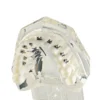 Evodent Four In One Orthodontic Bracket Types Demonstration Model – Metal, Ceramic, Self-Ligating &Amp; Lingual Braces 9 Evodent Four In One Orthodontic Bracket Types Demonstration Model – Metal, Ceramic, Self-Ligating &Amp; Lingual Braces