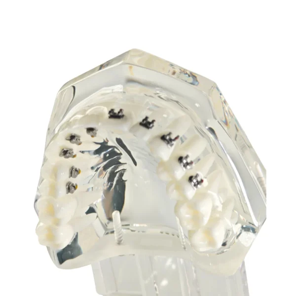 Evodent Four in One Orthodontic Bracket Types Demonstration Model – Metal, Ceramic, Self-Ligating & Lingual Braces