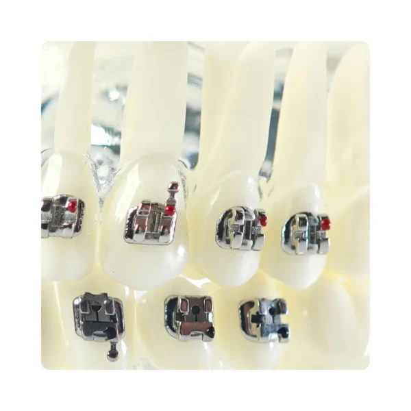 Evodent Four in One Orthodontic Bracket Types Demonstration Model – Metal, Ceramic, Self-Ligating & Lingual Braces