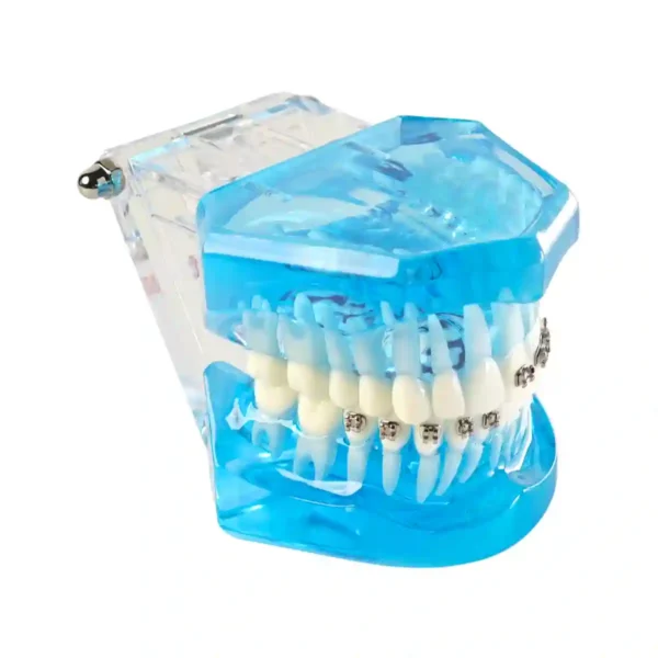 Evodent Orthodontic Model with Metal, Ceramic and Lingual Bracket Clear