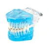Evodent Orthodontic Model With Metal, Ceramic And Lingual Bracket Clear