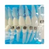 Evodent Orthodontic Model With Metal, Ceramic And Lingual Bracket Clear