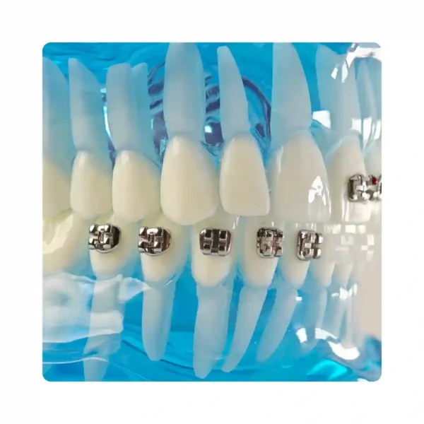 Evodent Orthodontic Model with Metal, Ceramic and Lingual Bracket Clear