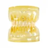 Evodent Pedodontic Model Foe 3 Year Child Showing Primary Dentition (Milk Teeth) With Early Permanent Teeth