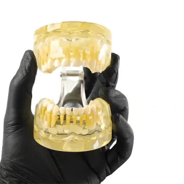 Evodent pedodontic Model foe 3 Year Child Showing Primary Dentition (Milk Teeth) with Early permanent Teeth