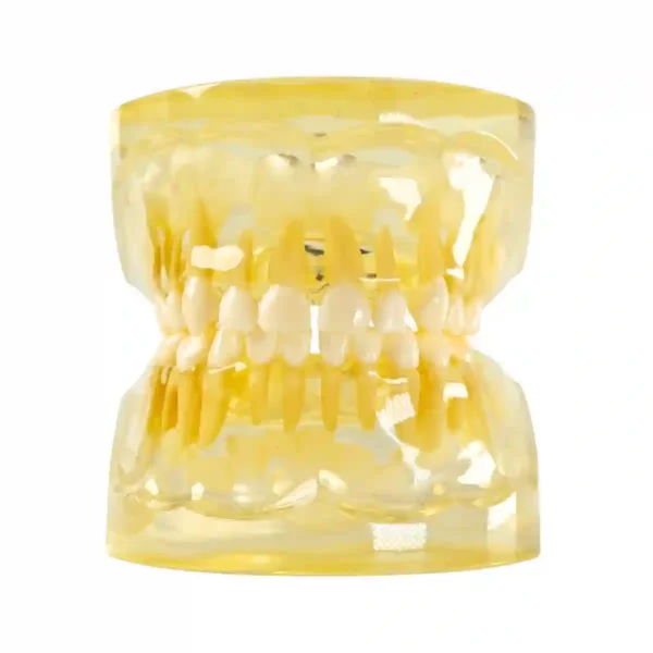 Evodent pedodontic Model foe 3 Year Child Showing Primary Dentition (Milk Teeth) with Early permanent Teeth