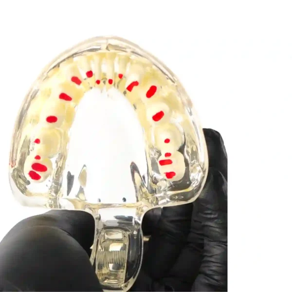 Evodent Pedodontic Model for 7 Years Child, Early Mixed Dentition and Erupting Permanent