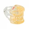 Evodent Pedodontic Model For 9 Years Child Late Mixed Dentition