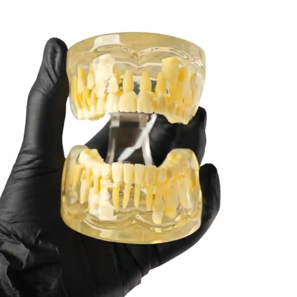 Evodent Pedodontic Model for 9 Years Child Late Mixed Dentition