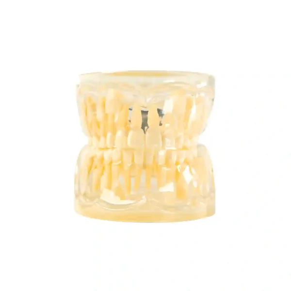 Evodent Pedodontic Model for 9 Years Child Late Mixed Dentition