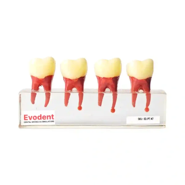 Evodent RCT Treatment Model with Post