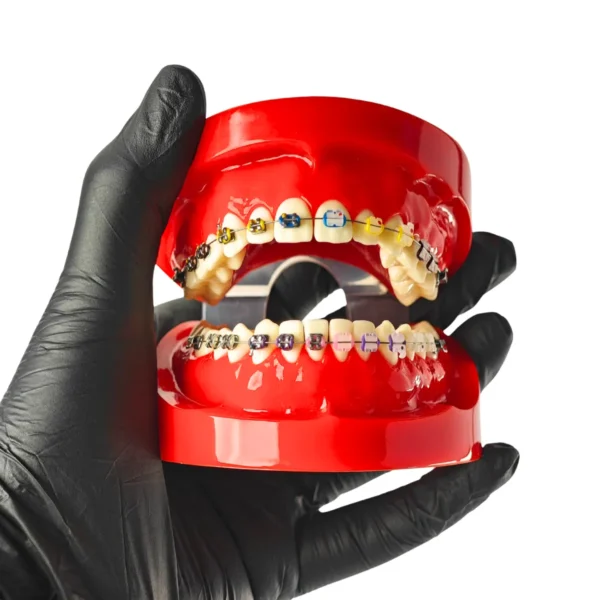 Evodent Orthodontic Bracket Model For Metal and Ceramic Bracket Red