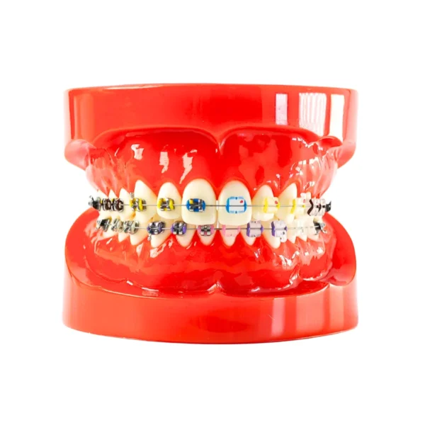 Evodent Orthodontic Bracket Model For Metal and Ceramic Bracket Red