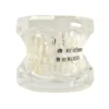 Evodent Orthodontic Model With Metal And Ceramic Bracket