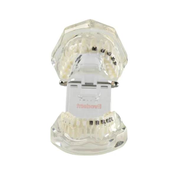 Evodent Orthodontic Model with Metal and Ceramic Bracket
