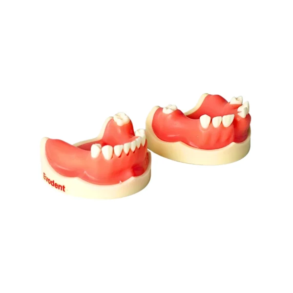 Evodent Partially Edentulous Implant Practice Model