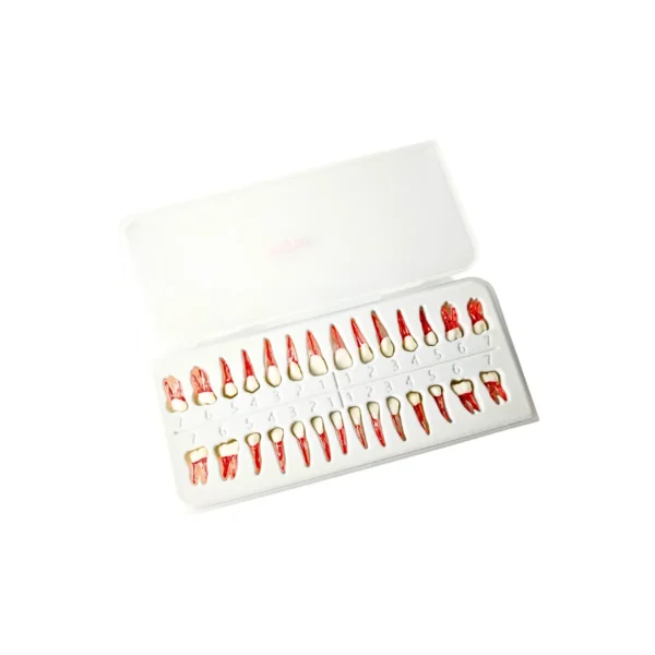 Evodent Atlas Root Canal Replacement Teeth