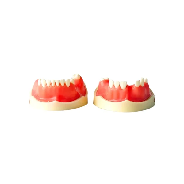 Evodent Partially Edentulous Implant Practice Model