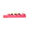 Evodent Periodontal Disease Progression Model, Patient Education
